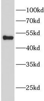 GSS Rabbit Polyclonal Antibody