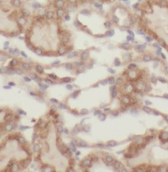 GSS Rabbit Polyclonal Antibody
