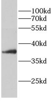 PPP1CA Rabbit Polyclonal Antibody