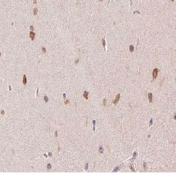 PPP1CA Rabbit Polyclonal Antibody
