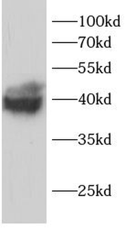 PPP1CC Rabbit Polyclonal Antibody