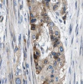 PPP1CC Rabbit Polyclonal Antibody