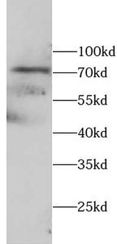 DHX58 Rabbit Polyclonal Antibody