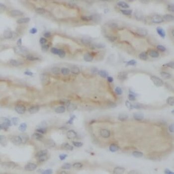 DHX58 Rabbit Polyclonal Antibody