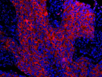 Rabbit 14-3-3 Sigma IHC Antibody