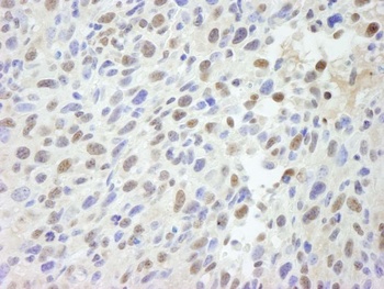 Rabbit MED12 IHC Antibody