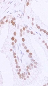 Rabbit 53BP1 IHC Antibody
