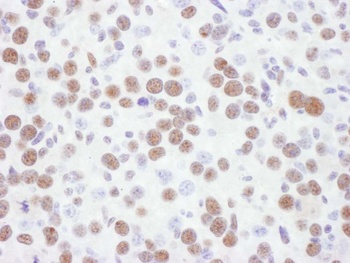 Rabbit 53BP1 IHC Antibody