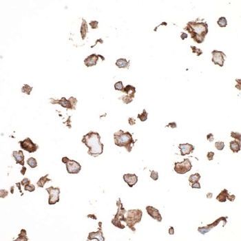 Rabbit anti-CD73 Recombinant Monoclonal Antibody