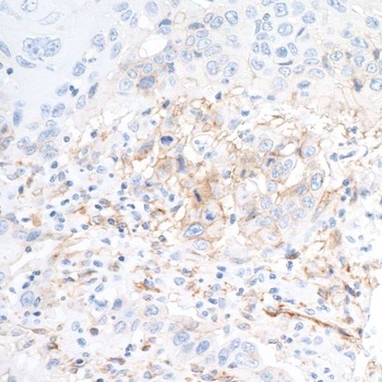 Rabbit anti-CD73 Recombinant Monoclonal Antibody