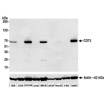 Rabbit anti-CD73 Recombinant Monoclonal Antibody