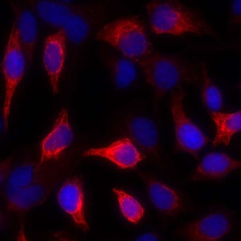 Mouse anti-Cytokeratin Monoclonal Antibody