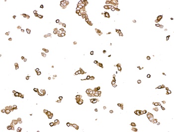 Mouse anti-Cytokeratin Monoclonal Antibody
