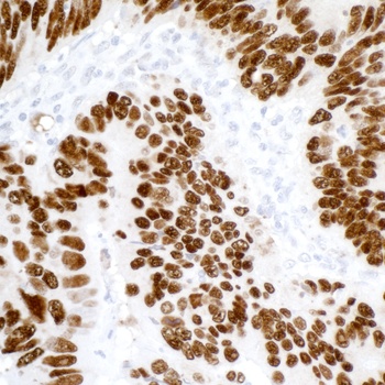 Mouse p53 Monoclonal Antibody