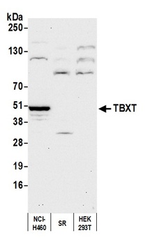 Rabbit TBXT Antibody