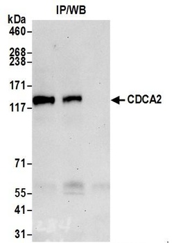 Rabbit CDCA2 Antibody