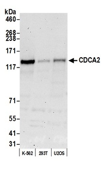 Rabbit CDCA2 Antibody