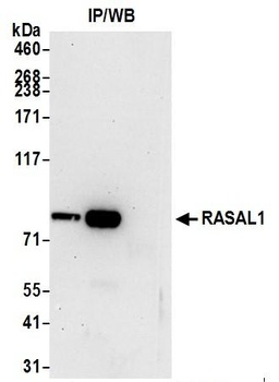 Rabbit RASAL1 Antibody