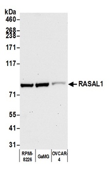 Rabbit RASAL1 Antibody