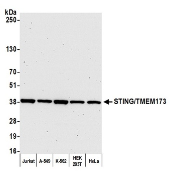 Rabbit STING/TMEM173 Antibody