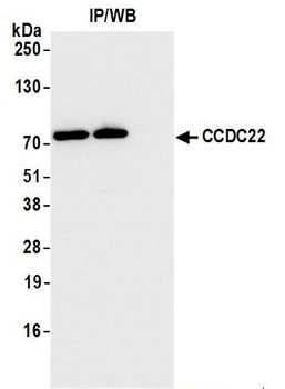 Rabbit CCDC22 Antibody