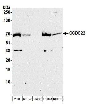 Rabbit CCDC22 Antibody