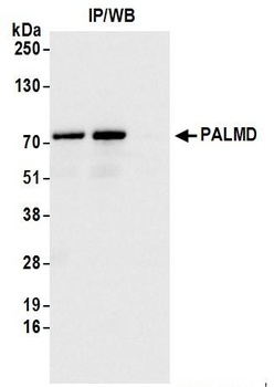Rabbit PALMD Antibody