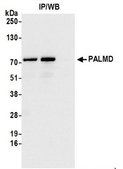 Rabbit PALMD Antibody