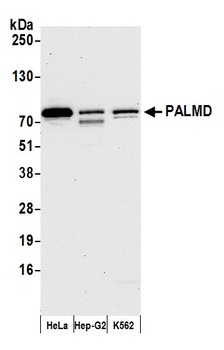 Rabbit PALMD Antibody