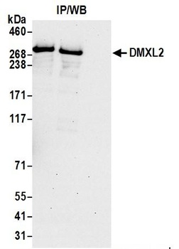 Rabbit DMXL2 Antibody
