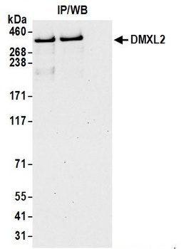 Rabbit DMXL2 Antibody