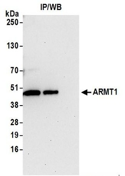 Rabbit ARMT1 Antibody