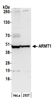 Rabbit ARMT1 Antibody
