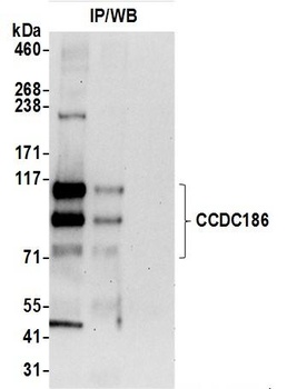 Rabbit CCDC186 Antibody