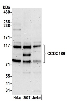 Rabbit CCDC186 Antibody
