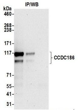 Rabbit CCDC186 Antibody