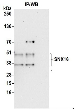 Rabbit SNX16 Antibody