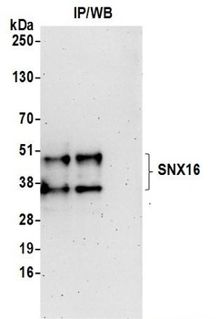 Rabbit SNX16 Antibody