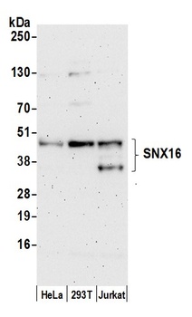 Rabbit SNX16 Antibody