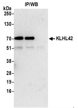 Rabbit KLHL42 Antibody