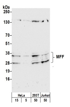Rabbit MFF Antibody