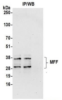 Rabbit MFF Antibody