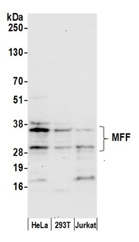 Rabbit MFF Antibody