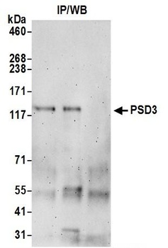 Rabbit PSD3 Antibody