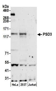 Rabbit PSD3 Antibody