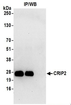 Rabbit CRIP2 Antibody