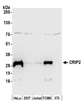 Rabbit CRIP2 Antibody