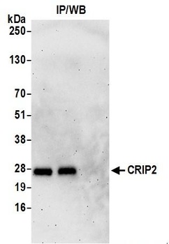 Rabbit CRIP2 Antibody