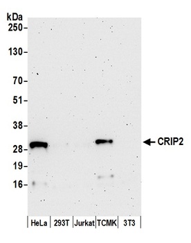 Rabbit CRIP2 Antibody