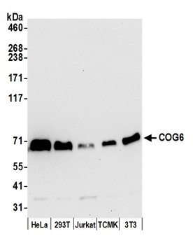 Rabbit COG6 Antibody